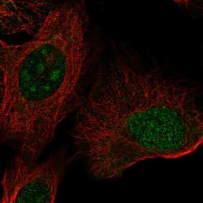 Immunocytochemistry/ Immunofluorescence: ZNF771 Antibody [NBP2-55199]