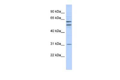 Western Blot: ZNF775 Antibody [NBP3-09218]