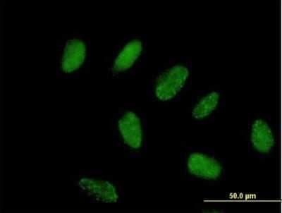 Immunocytochemistry/ Immunofluorescence: ZNF776 Antibody [H00284309-B01P]