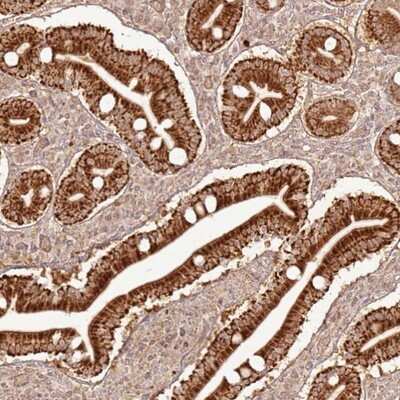 Immunohistochemistry-Paraffin: ZNF776 Antibody [NBP1-92644]