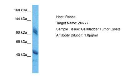 Western Blot: ZNF777 Antibody [NBP2-88739]