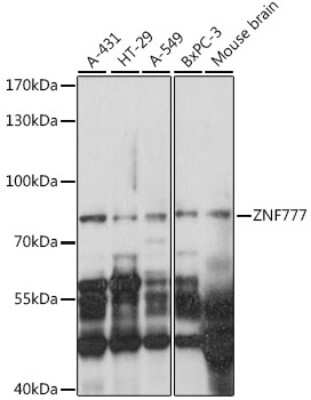 Western Blot: ZNF777 AntibodyAzide and BSA Free [NBP2-93823]