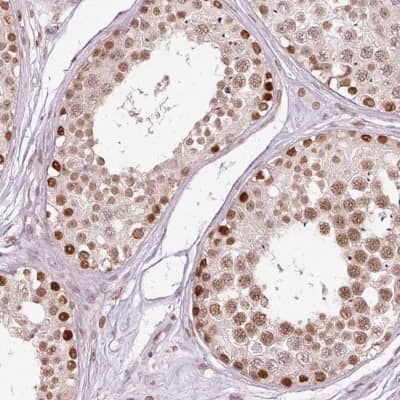 Immunohistochemistry-Paraffin: ZNF778 Antibody [NBP2-33637]