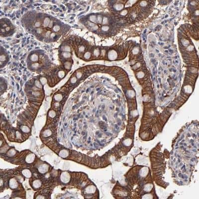 Immunohistochemistry-Paraffin: ZNF780B Antibody [NBP1-80588]