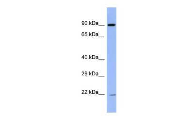 Western Blot: ZNF780B Antibody [NBP2-86455]