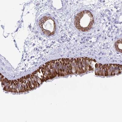 Immunohistochemistry-Paraffin: ZNF781 Antibody [NBP2-38964]