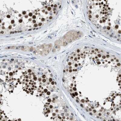 Immunohistochemistry-Paraffin: ZNF783 Antibody [NBP1-85058]
