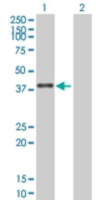 Western Blot: ZNF783 Antibody [H00155060-B01P]