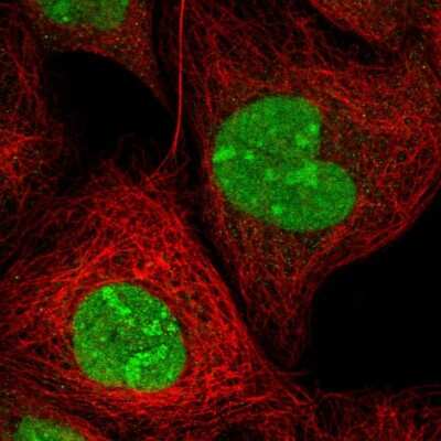 Immunocytochemistry/ Immunofluorescence: ZNF787 Antibody [NBP1-85911]