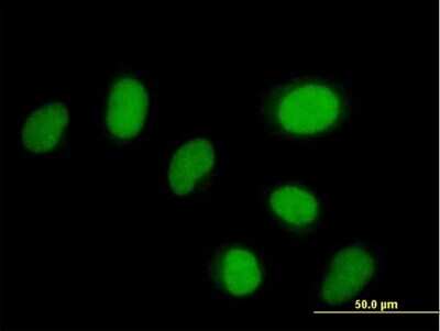 Immunocytochemistry/ Immunofluorescence: ZNF792 Antibody [H00126375-B01P]