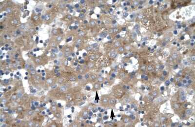 Immunohistochemistry-Paraffin: ZNF81 Antibody [NBP1-79990]