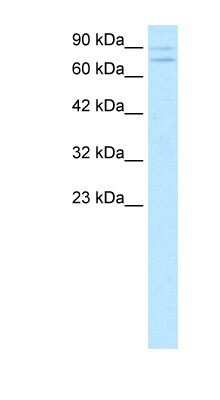 Western Blot: ZNF81 Antibody [NBP1-79990]