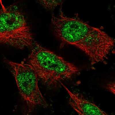 Immunocytochemistry/ Immunofluorescence: ZNF821 Antibody [NBP1-86290]