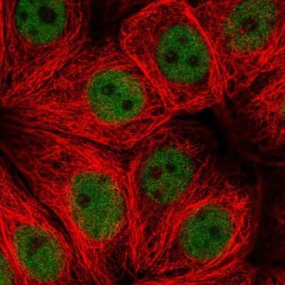 Immunocytochemistry/ Immunofluorescence: ZNF821 Antibody [NBP2-55186]
