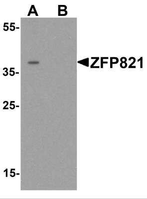 Western Blot: ZNF821 AntibodyBSA Free [NBP2-82055]