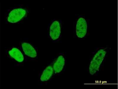 Immunocytochemistry/ Immunofluorescence: ZNF828 Antibody [H00283489-B01P]