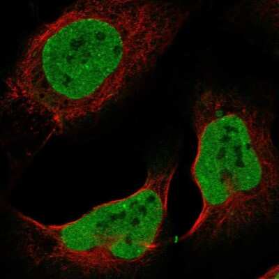 Immunocytochemistry/ Immunofluorescence: ZNF828 Antibody [NBP1-88402]