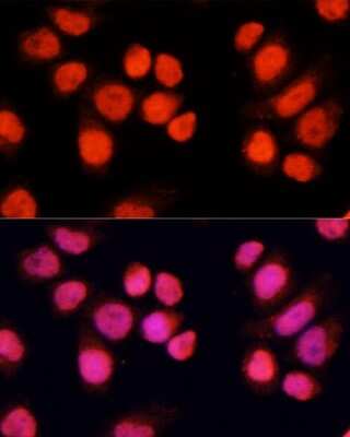 Immunocytochemistry/ Immunofluorescence: ZNF828 Antibody - Azide and BSA Free [NBP2-93670]