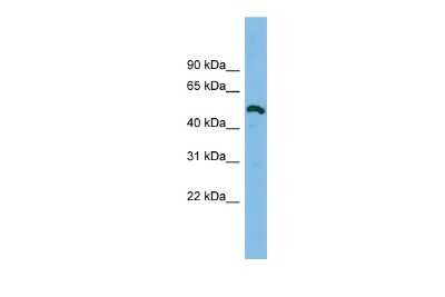 Western Blot: ZNF829 Antibody [NBP2-83913]
