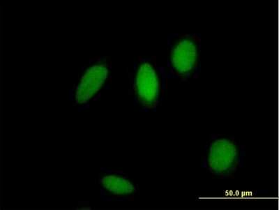 Immunocytochemistry/ Immunofluorescence: ZNF83 Antibody [H00055769-B01P]