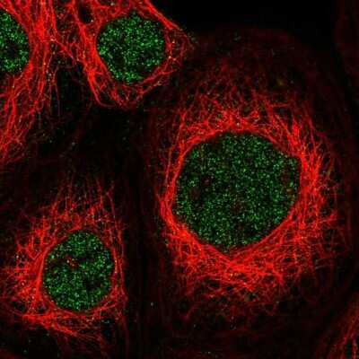Immunocytochemistry/ Immunofluorescence: ZNF83 Antibody [NBP1-83789]
