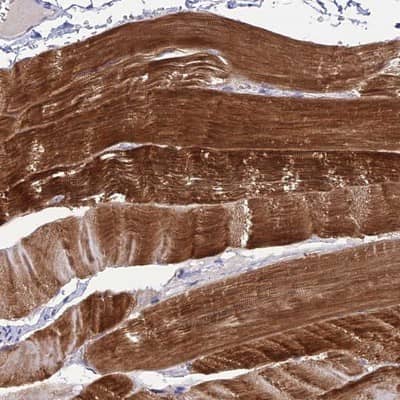 Immunohistochemistry-Paraffin: ZNF837 Antibody [NBP1-90888]