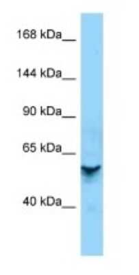 Western Blot: ZNF840P Antibody [NBP3-09283]