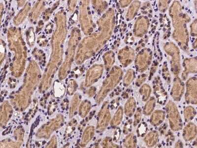Immunohistochemistry-Paraffin: ZNF842 Antibody [NBP2-98003]