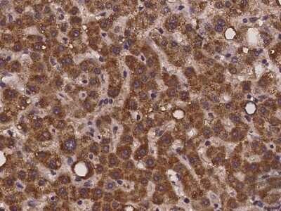 Immunohistochemistry-Paraffin: ZNF842 Antibody [NBP2-98003]