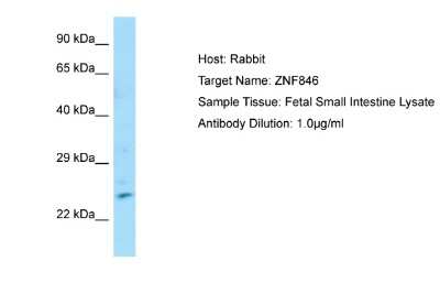 Western Blot: ZNF846 Antibody [NBP2-86558]