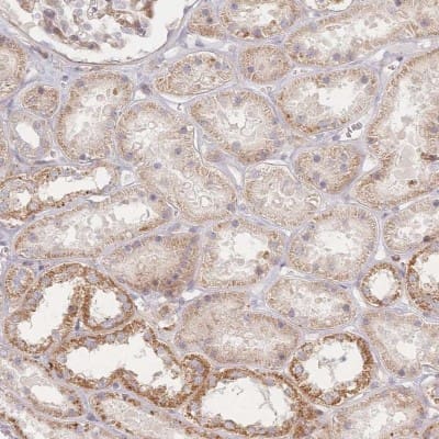 Immunohistochemistry-Paraffin: ZNF852 Antibody [NBP2-14804]