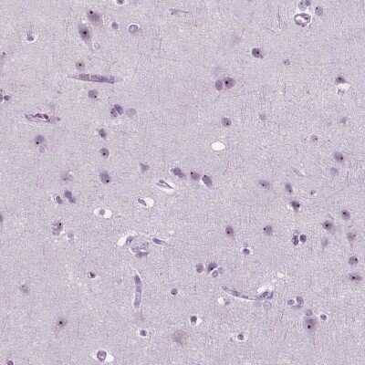 Immunohistochemistry-Paraffin: ZNF853 Antibody [NBP2-49527]