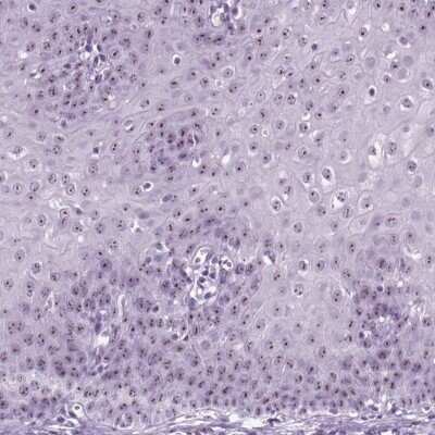 Immunohistochemistry-Paraffin: ZNF865 Antibody [NBP2-57297]