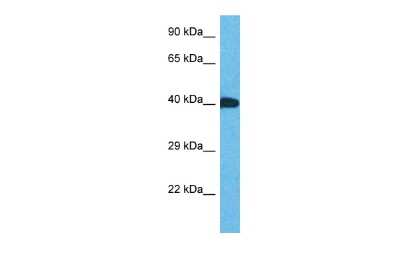 Western Blot: ZNF883 Antibody [NBP3-09186]