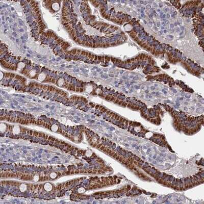 Immunohistochemistry-Paraffin: ZNF891 Antibody [NBP1-90894]