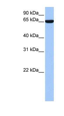 Western Blot: ZNF891 Antibody [NBP1-91383]
