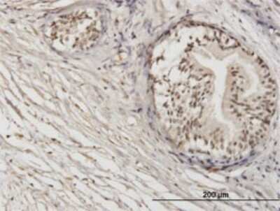 Immunohistochemistry-Paraffin: ZNF92 Antibody (1F2) [H00168374-M01]