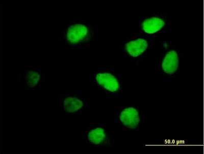 Immunocytochemistry/ Immunofluorescence: ZNFN1A4 Antibody [H00064375-B01P]