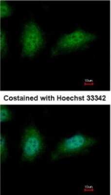 Immunocytochemistry/ Immunofluorescence: ZNHIT2 Antibody [NBP2-15179]