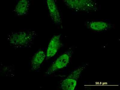 Immunocytochemistry/ Immunofluorescence: ZNHIT3 Antibody (2F8) [H00009326-M09]
