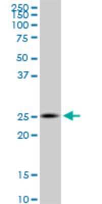 Western Blot: ZNHIT3 Antibody (2F8) [H00009326-M09]