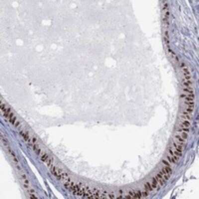 Immunohistochemistry-Paraffin: ZNHIT3 Antibody [NBP3-17332]