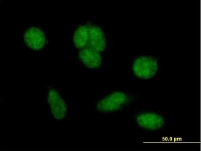 Immunocytochemistry/ Immunofluorescence: ZNHIT6 Antibody [H00054680-B01P]