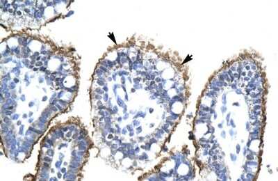 Immunohistochemistry: ZNHIT6 Antibody [NBP2-86565]