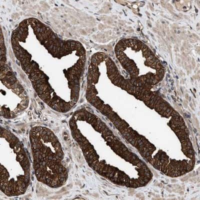 Immunohistochemistry-Paraffin: ZNHIT6 Antibody [NBP1-88683]
