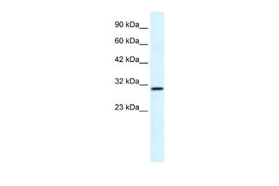 Western Blot: ZNHIT6 Antibody [NBP2-86565]