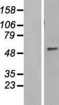 Western Blot: ZNHIT6 Overexpression Lysate [NBP2-06893]