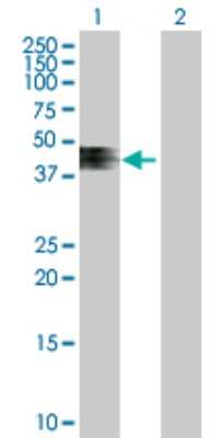Western Blot: ZNRF4 Antibody [H00148066-B01P]