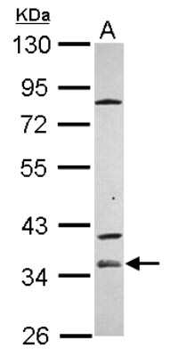 Western Blot: ZP1 Antibody [NBP2-21052]