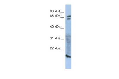 Western Blot: ZP1 Antibody [NBP2-84368]
